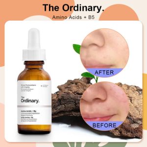 سرم آمینو اسید + B5 اوردینری با نتایج قبل و بعد از استفاده برای بهبود بافت و آبرسانی پوست.