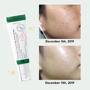Axis-y Dark Spot Correcting Serum